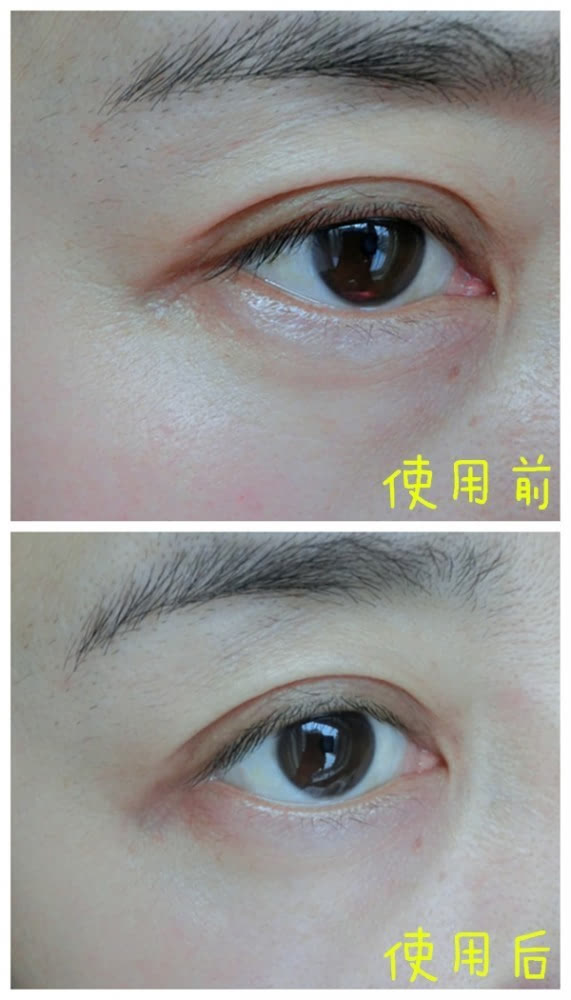 VIIcode夜間氧眼貼抗老效果怎么樣？VIIcode眼膜使用測評