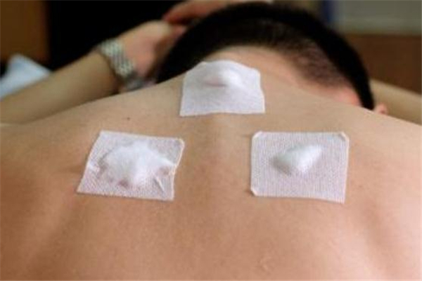 貼過三伏貼后多久可以懷孕 貼三伏貼后懷孕怎么辦 貼過三伏貼后多久可以懷孕 貼三伏貼后懷孕怎么辦