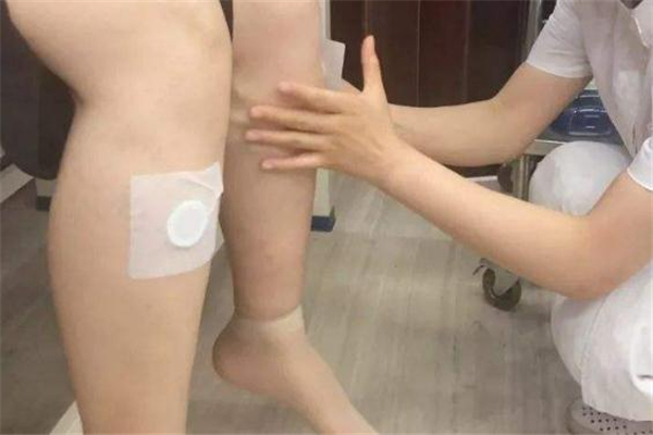 準備懷孕可以貼三伏貼嗎 貼三伏貼對懷孕有影響嗎 準備懷孕可以貼三伏貼嗎 貼三伏貼對懷孕有影響嗎