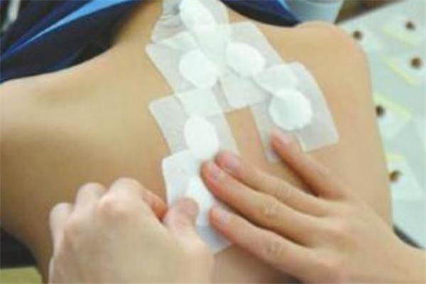 三伏貼長(zhǎng)毛了還能貼嗎 三伏貼長(zhǎng)毛什么原因 三伏貼長(zhǎng)毛了還能貼嗎 三伏貼長(zhǎng)毛什么原因