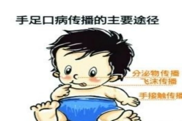 什么是手足口病 為什么會得手足口病 什么是手足口病 為什么會得手足口病
