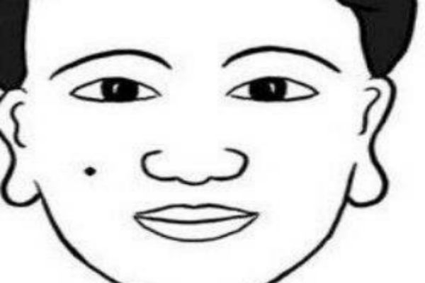 點(diǎn)痣后的注意事項(xiàng)有什么 點(diǎn)痣的方法有什么