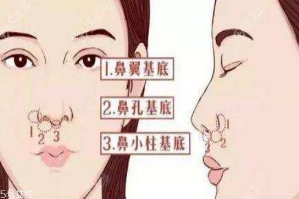 鼻基底填充有無(wú)副作用呢 鼻基底填充的價(jià)格有什么呢