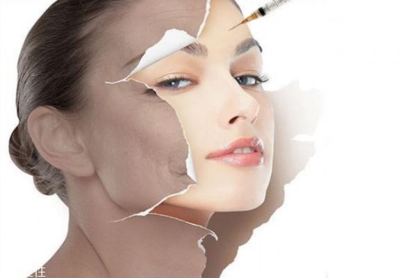 做完整形手術(shù)后多久可以見(jiàn)人 關(guān)于整形你知道多少 做完整形手術(shù)后多久可以見(jiàn)人 關(guān)于整形你知道多少