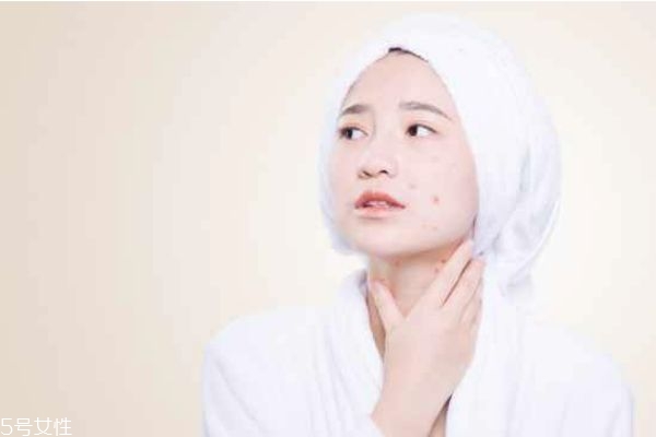 臉上毛孔很大的女生怎樣化妝好看 怎樣化妝隱形毛孔 臉上毛孔很大的女生怎樣化妝好看 怎樣化妝隱形毛孔