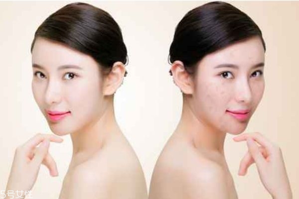 臉上毛孔很大的女生怎樣化妝好看 怎樣化妝隱形毛孔 臉上毛孔很大的女生怎樣化妝好看 怎樣化妝隱形毛孔