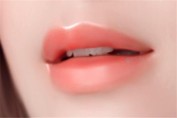 嘟嘟唇會腫幾天能消腫 嘟嘟唇豐唇保持多久 嘟嘟唇會腫幾天能消腫 嘟嘟唇豐唇保持多久