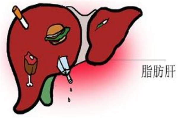 脂肪肝一點(diǎn)肉都不能吃嗎 脂肪肝怎樣正確吃肉 脂肪肝一點(diǎn)肉都不能吃嗎 脂肪肝怎樣正確吃肉