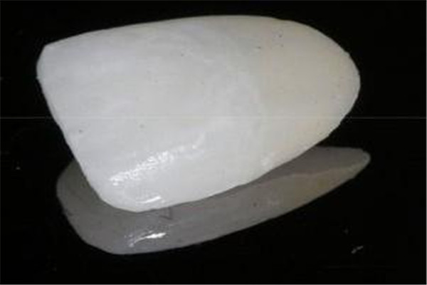 牙齒貼面能維持多久 維持時(shí)間取決于很多因素 牙齒貼面能維持多久 維持時(shí)間取決于很多因素