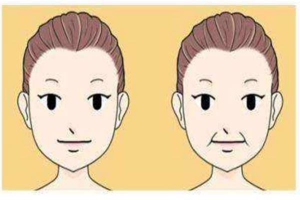 什么是電波拉皮呢 電波拉皮有什么用呢 什么是電波拉皮呢 電波拉皮有什么用呢