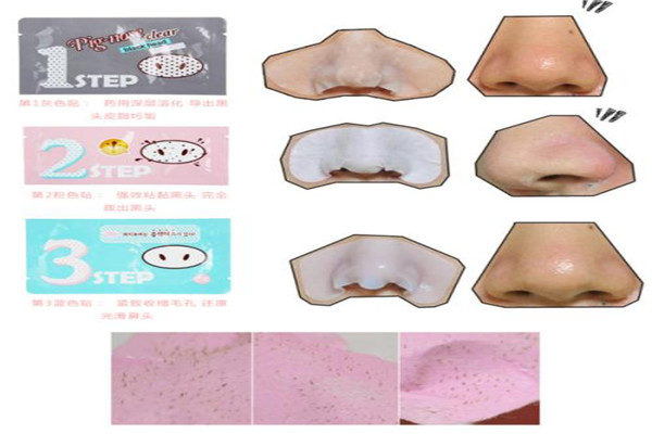 黑頭貼多久用一次 黑頭貼效果好嗎 黑頭貼多久用一次 黑頭貼效果好嗎