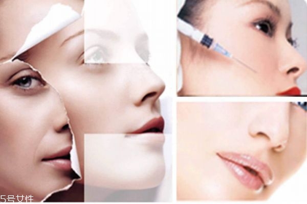 愛貝芙一針多少錢呢 愛貝芙一針可以持續(xù)多久呢