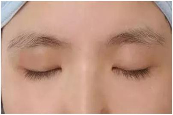 眉毛紋了怎么洗掉 眉毛紋了不好看怎么辦 眉毛紋了怎么洗掉 眉毛紋了不好看怎么辦