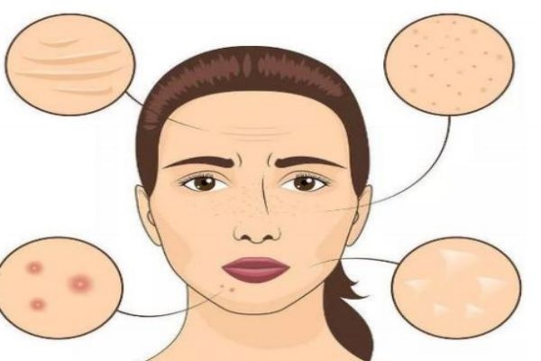 什么是熱瑪吉呢 熱瑪吉有什么用呢 什么是熱瑪吉呢 熱瑪吉有什么用呢