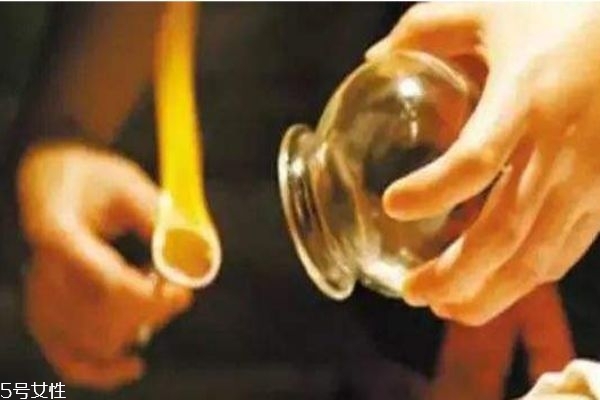 拔罐有什么好處呢 什么人群不適合拔罐呢 拔罐有什么好處呢 什么人群不適合拔罐呢