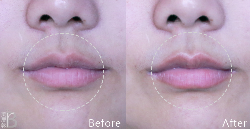 敏感肌秋冬怎么保養(yǎng) 這樣保養(yǎng)可解決 敏感肌秋冬怎么保養(yǎng) 這樣保養(yǎng)可解決