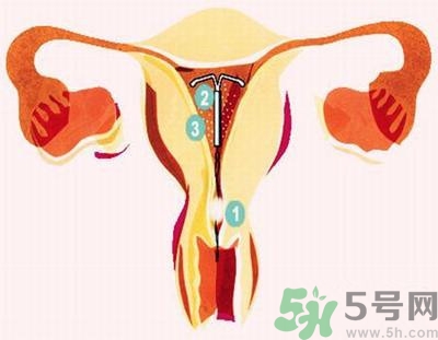 上環(huán)的最佳時(shí)間是什么時(shí)候？上環(huán)的壞處是什么？