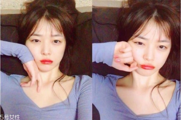 法國水光針菲洛嘉好嗎 菲洛嘉水光針的效果 法國水光針菲洛嘉好嗎 菲洛嘉水光針的效果