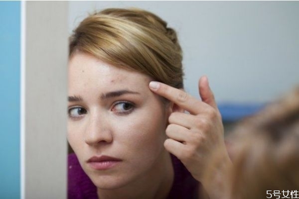 眉毛附近長痘痘是什么原因 眉毛中間長了痘痘的原因 眉毛附近長痘痘是什么原因 眉毛中間長了痘痘的原因