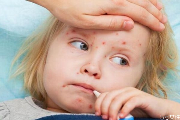 什么是風(fēng)疹呢 風(fēng)疹有什么危害呢 什么是風(fēng)疹呢 風(fēng)疹有什么危害呢