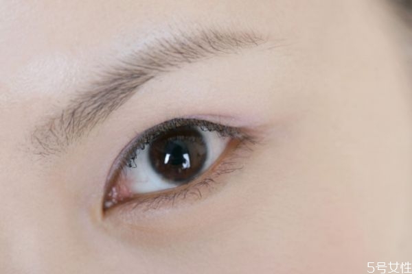 開內(nèi)眼角眼睛會(huì)變大嗎 開內(nèi)眼角恢復(fù)過程
