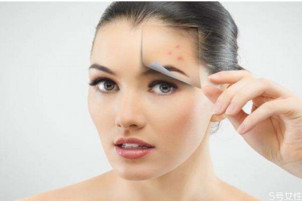 為什么剛長好地方又出現(xiàn)痘痘呢 痘痘為什么會(huì)反復(fù)呢 為什么剛長好地方又出現(xiàn)痘痘呢 痘痘為什么會(huì)反復(fù)呢