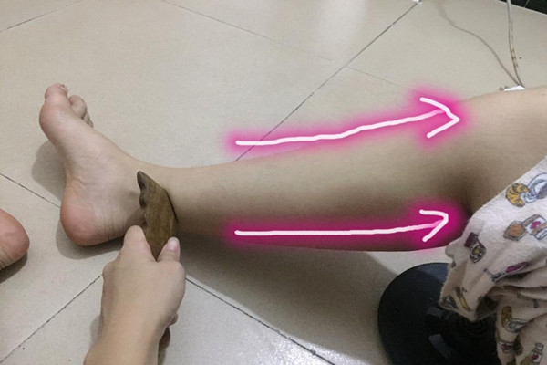 刮痧瘦腿能天天刮嗎 刮痧瘦腿的正確方法 刮痧瘦腿能天天刮嗎 刮痧瘦腿的正確方法