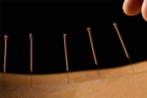 針灸減肥價(jià)格是多少 針灸減肥會(huì)反彈嗎 針灸減肥價(jià)格是多少 針灸減肥會(huì)反彈嗎