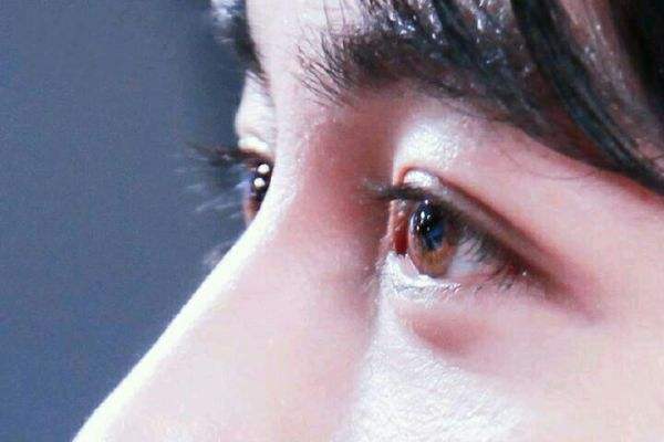 眼部皮膚過敏怎么辦 眼部皮膚過敏的表現(xiàn) 眼部皮膚過敏怎么辦 眼部皮膚過敏的表現(xiàn)