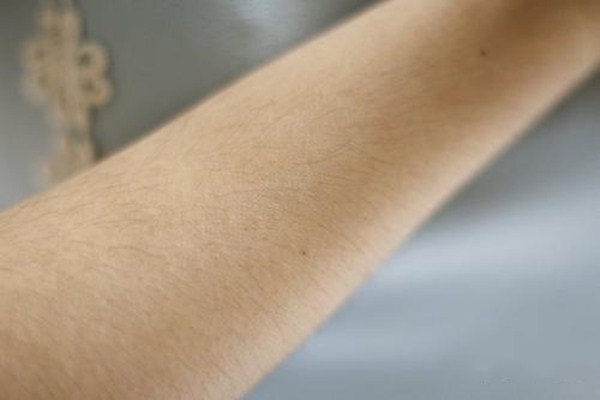 唇毛激光脫毛還會(huì)長嗎 激光脫毛痛嗎