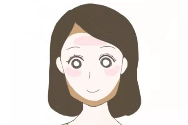 自體脂肪豐蘋果肌多久可以洗臉 自體脂肪豐臉后多久能恢復(fù) 自體脂肪豐蘋果肌多久可以洗臉 自體脂肪豐臉后多久能恢復(fù)