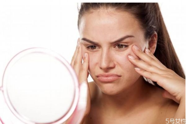 為什么額頭會(huì)有閉口粉刺呢 造成額頭閉口粉刺是什么呢