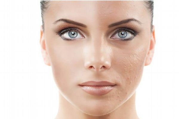 皮膚暗沉發(fā)黃應該怎么辦呢 如何美白皮膚呢 皮膚暗沉發(fā)黃應該怎么辦呢 如何美白皮膚呢