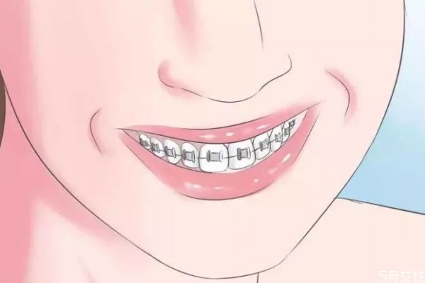 敏感牙齒怎么做脫敏治療呢 牙齒脫敏治療需要多少錢(qián)呢 敏感牙齒怎么做脫敏治療呢 牙齒脫敏治療需要多少錢(qián)呢