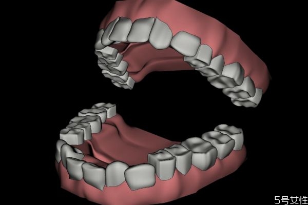 敏感牙齒怎么做脫敏治療呢 牙齒脫敏治療需要多少錢(qián)呢 敏感牙齒怎么做脫敏治療呢 牙齒脫敏治療需要多少錢(qián)呢
