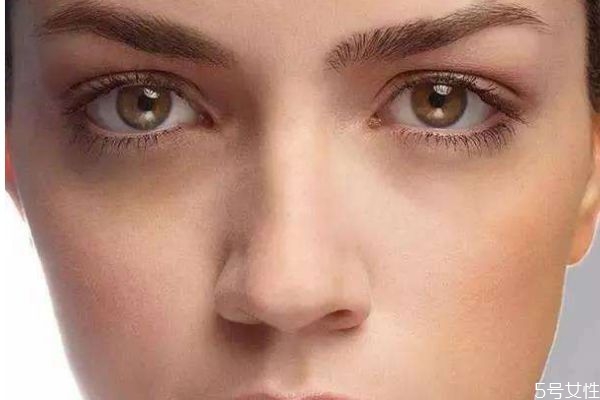 黑眼圈會自愈嗎 如何去除黑眼圈呢 黑眼圈會自愈嗎 如何去除黑眼圈呢