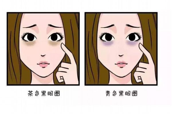 黑眼圈會自愈嗎 如何去除黑眼圈呢 黑眼圈會自愈嗎 如何去除黑眼圈呢