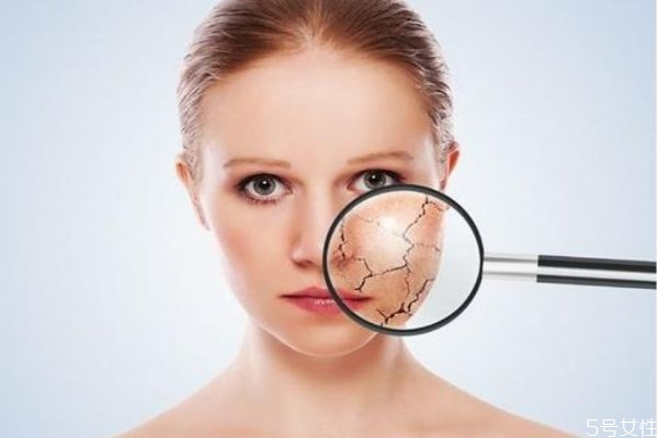 皮膚干燥缺水怎么補水 快速補水的方法 皮膚干燥缺水怎么補水 快速補水的方法