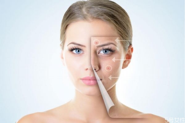 產(chǎn)后臉上長斑怎么辦 產(chǎn)后臉上長斑什么原因 產(chǎn)后臉上長斑怎么辦 產(chǎn)后臉上長斑什么原因