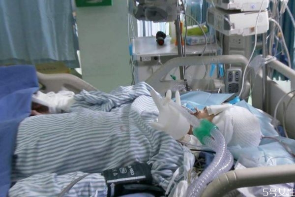 什么是腦死亡呢 腦死亡等于死亡嗎 什么是腦死亡呢 腦死亡等于死亡嗎