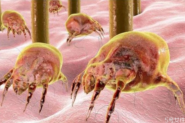 有螨蟲的表現(xiàn)是什么呢 螨蟲的危害有什么呢 有螨蟲的表現(xiàn)是什么呢 螨蟲的危害有什么呢