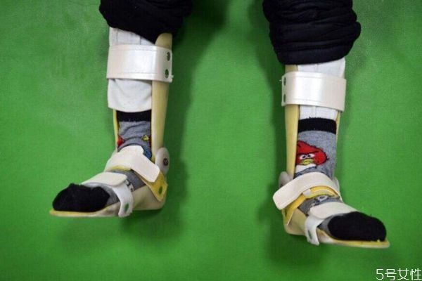 什么是腦癱呢 腦癱有什么癥狀呢 什么是腦癱呢 腦癱有什么癥狀呢