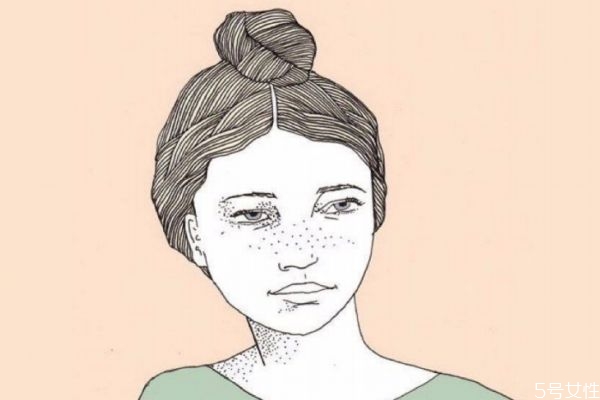 如何淡化雀斑呢 淡化雀斑的方法有什么呢 如何淡化雀斑呢 淡化雀斑的方法有什么呢