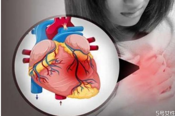 急性心肌梗死的癥狀有什么呢 急性心肌梗死怎么辦呢 急性心肌梗死的癥狀有什么呢 急性心肌梗死怎么辦呢