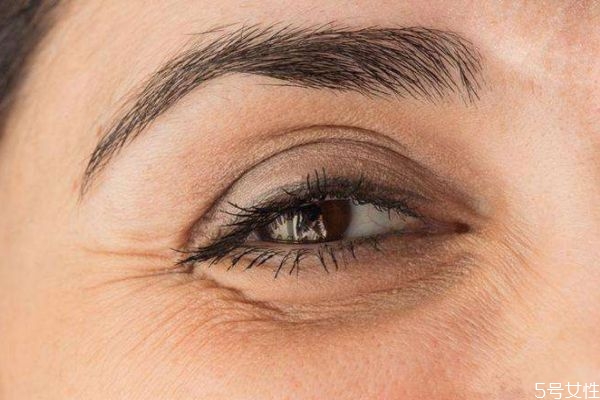 眼部細紋造成原因有什么呢 為什么會出現(xiàn)眼部細紋呢 眼部細紋造成原因有什么呢 為什么會出現(xiàn)眼部細紋呢