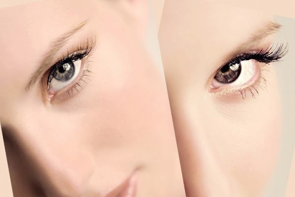 什么是睫毛移植術 睫毛移植術的適應范圍