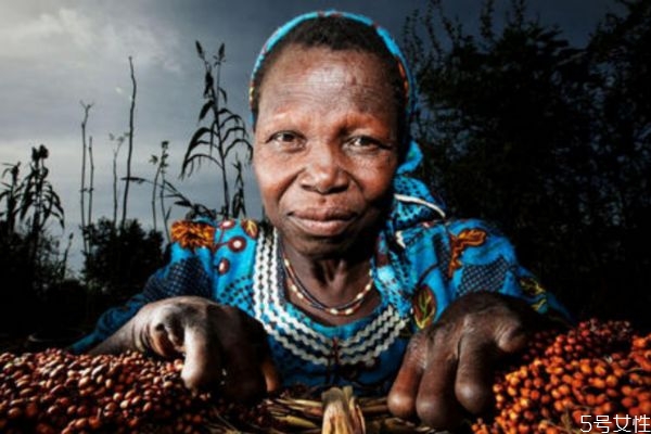 麻風病是怎么造成的呢 造成麻風病的原因有什么呢