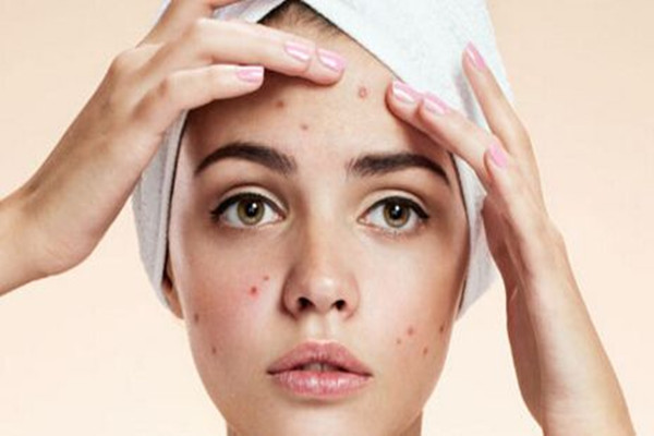 痘印消失的時(shí)間跟膚色有關(guān)嗎 痘印要多久能消除