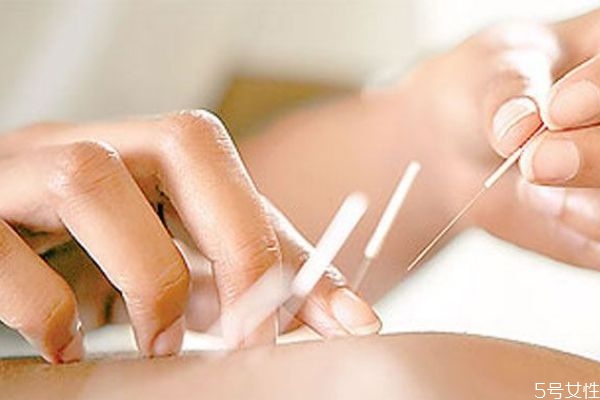 什么是埋線減肥呢 埋線減肥好不好呢 什么是埋線減肥呢 埋線減肥好不好呢