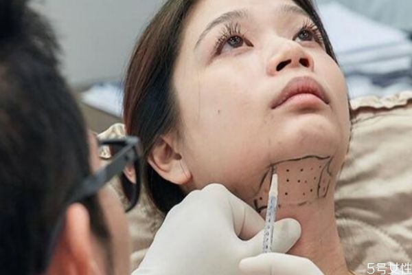 雙下巴溶脂后幾天看見(jiàn)效果 雙下巴溶脂效果是永久的嗎